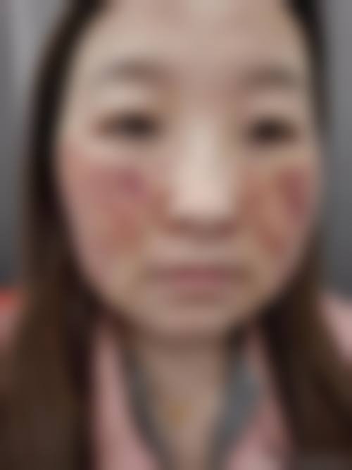 南宁星城医疗美容门诊部治疗反馈与口碑评价。