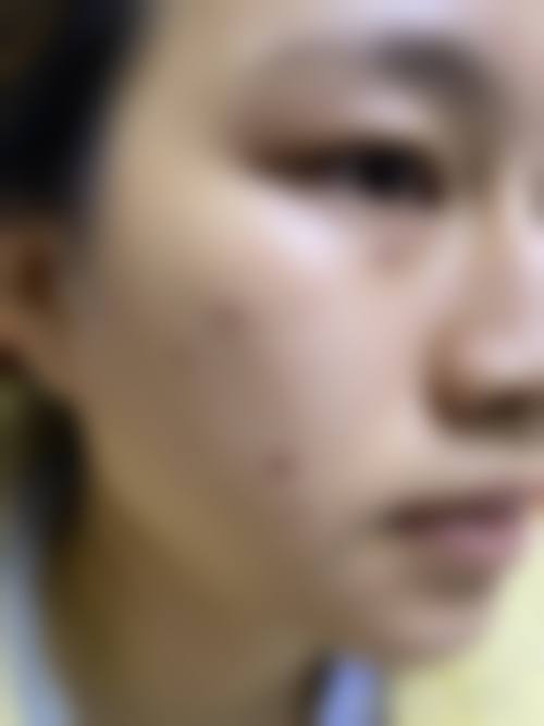优惠活动详情:面诊预约享限时特价