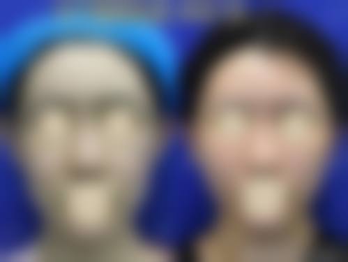 服务流程与患者保护——从询问到术后全程专精关怀