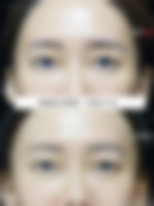 恩施州轻颜整形医院擅长项目。