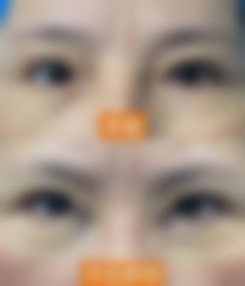预约优惠活动