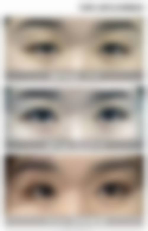 苏州威沃眼科诊所预约挂号方式。