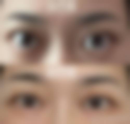 朔州爱尔眼科医院门诊营业时间。
