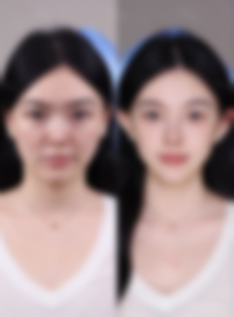 七、广州尚美善造整形门诊部“黄金眼”技术怎么样