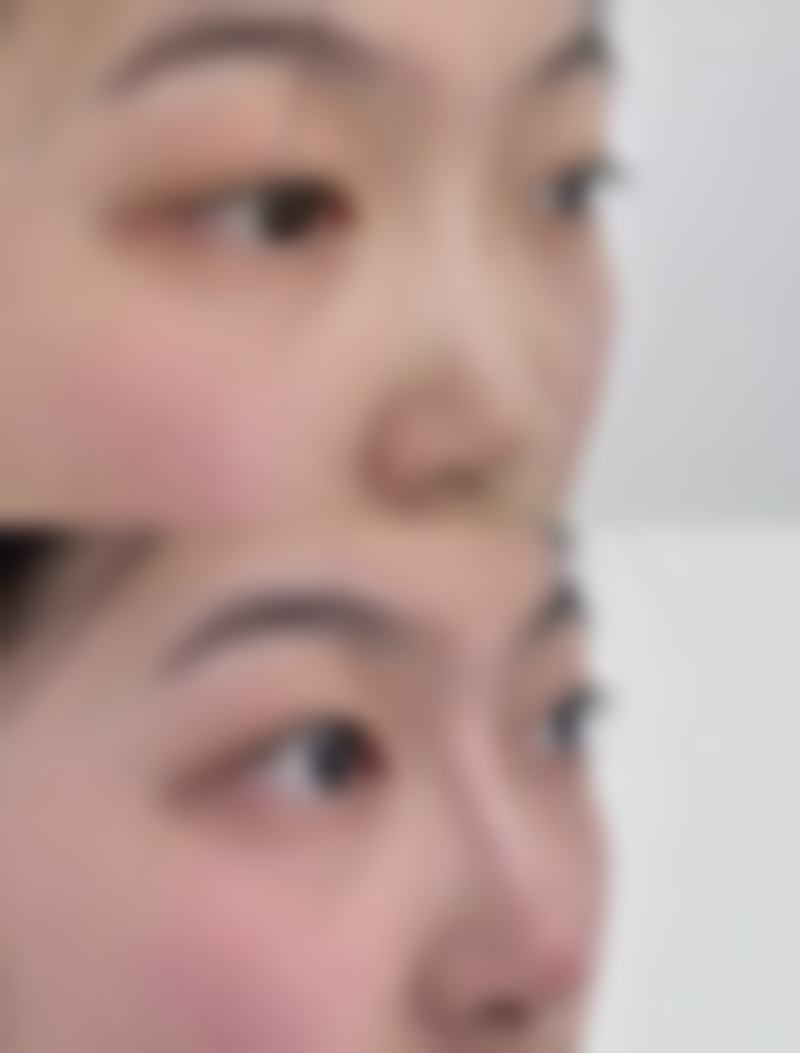 十、广州南珠整形美容中 心患者常见问题解答(精选 )