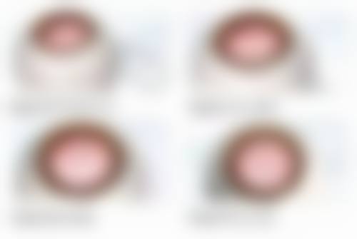 十、相关科普内容推荐——小儿弱视诊疗