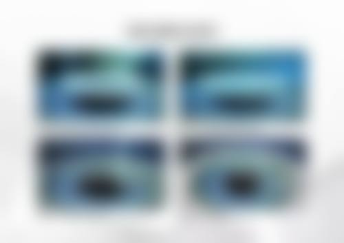 十、邱志方擅长飞秒激光白内障手术科普