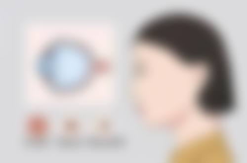 六、西安康菲特眼科门诊部眼科真实实例参考