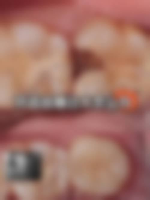 贵阳拜博口腔的项目价格
