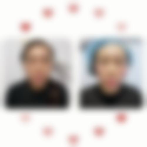 韩国Beauty＆Young皮肤科治疗反馈与口碑评价。