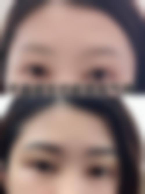二、昆山新生植发医院正规可靠吗?