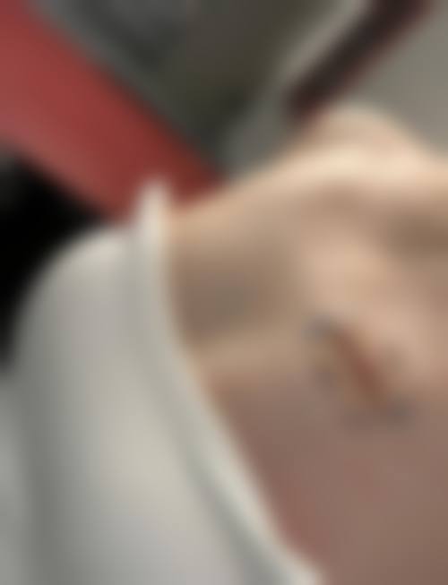 三、疤痕疙瘩内服药大盘点