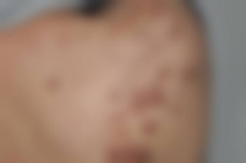 二、上海愉悦美联臣整形医疗美容医院怎么样
