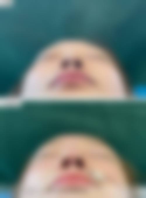 夏门华美医疗美容医院预约挂号方式。