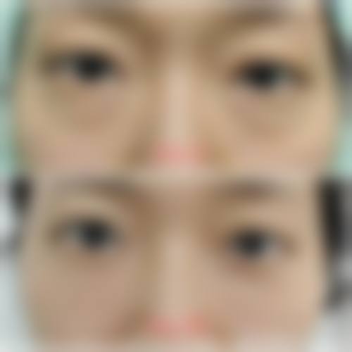 结语:三等甲品质,安心变得更美