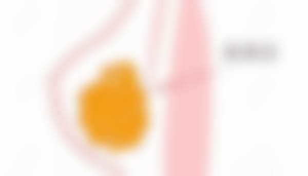 田天医生擅长的项目