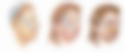 韓國TS術後恢復快嗎？2026真實評價！醫生拆解恢復期要幾耐？路人實測