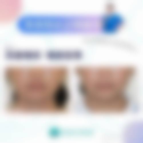 精良设备与环境:提升诊疗精细度
