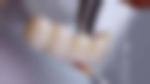 广东东莞天健口腔项目优势明显。
