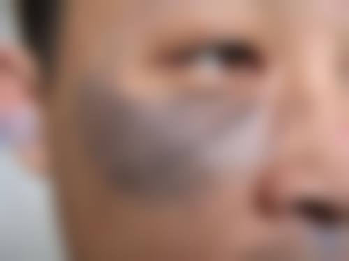 深圳和美妇儿科医院医疗美容医院整形科医生团队经验稳定。