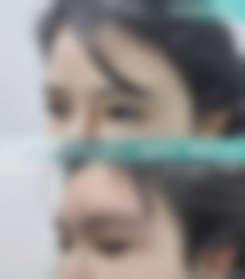三、南宁亚韩整形美容医院是国有还是私立呢?