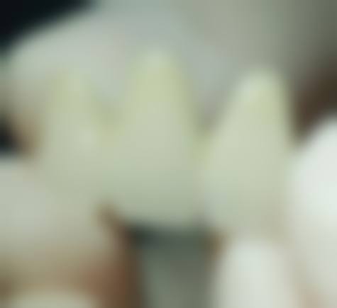 精良设备与无菌环境：确保治疗安心