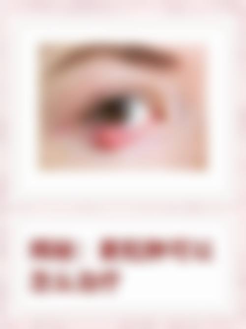 成都龙泉驿欧普眼视光眼科诊所预约挂号方式。