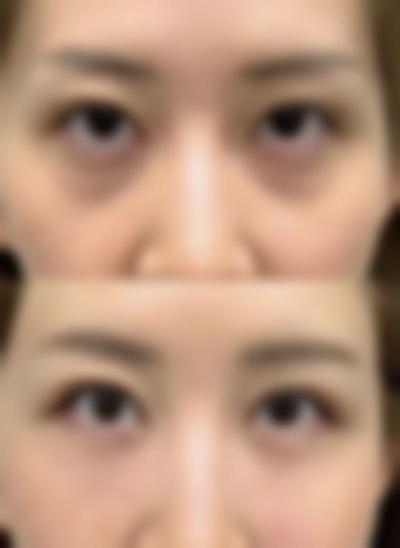理性提醒