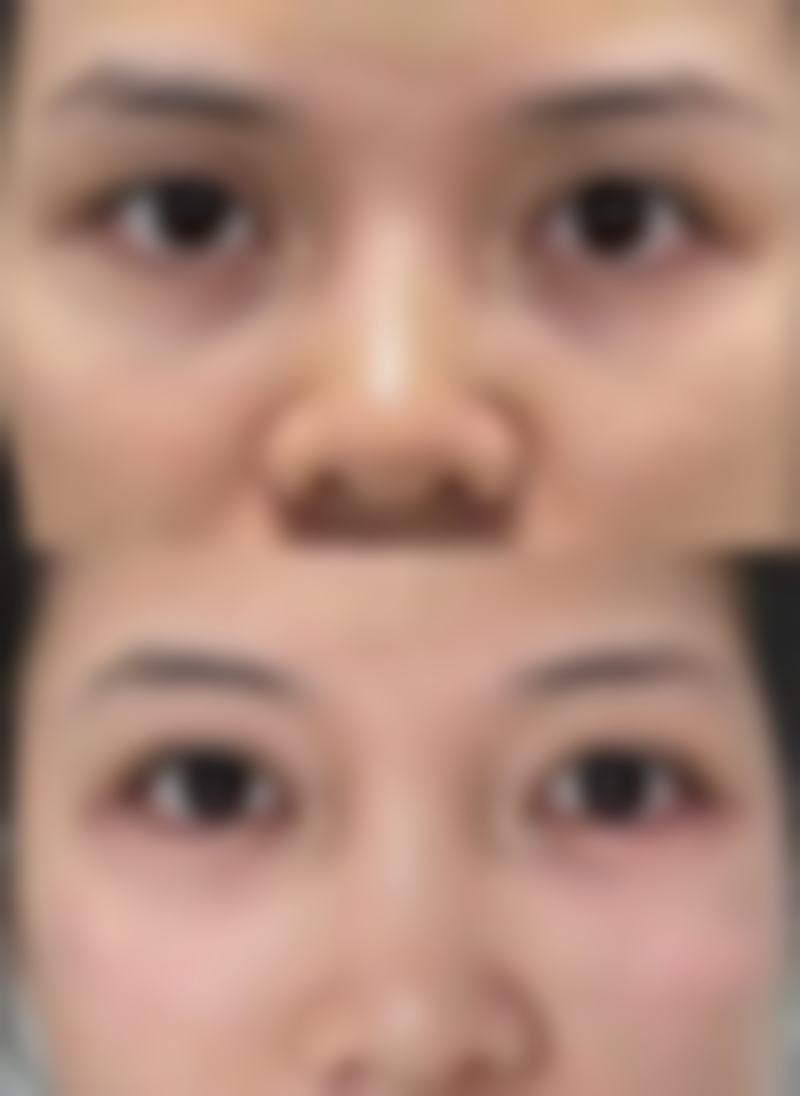 南宁亚韩整形美容医院温馨提示——为了节省您的时间,看诊前请预约哦!
