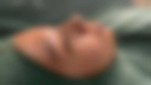 韓國GNG鼻整形好唔好 適合邊類人群?