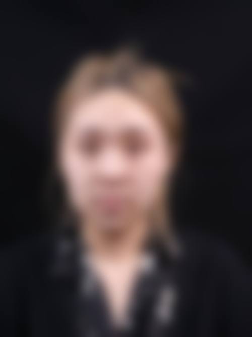 韓國GNG鼻整形好唔好 權威醫生團隊夠唔夠班?