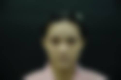 韓國GNG鼻整形好唔好 價錢範圍(HKD/MOP)大公開!