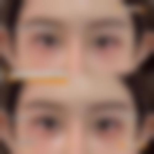 北京东南整形医疗美容医院擅长项目。