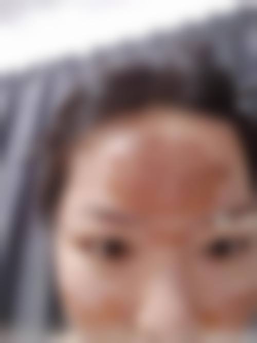 摩兹皮肤科擅长项目。