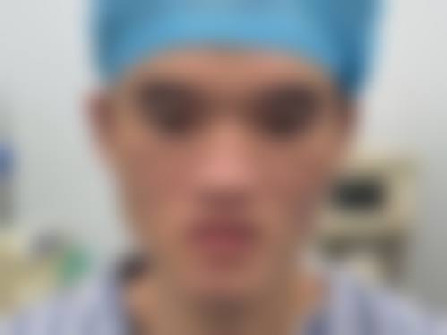 韓國GNG鼻整形好唔好 預約方式+注意事項