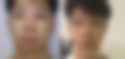 北京东南整形医疗美容医院治疗反馈与口碑评价。