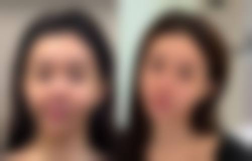 拓展延伸：韓國醫美vs港澳本地醫美，邊個更啱你？