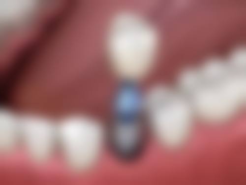 舒适体验与患者服务
