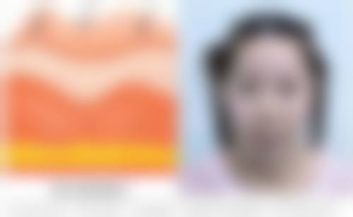 成都瑛爱整形医疗美容门诊部门诊营业时间。