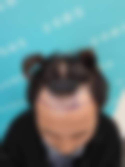 1、主要做的三大诊疗项目