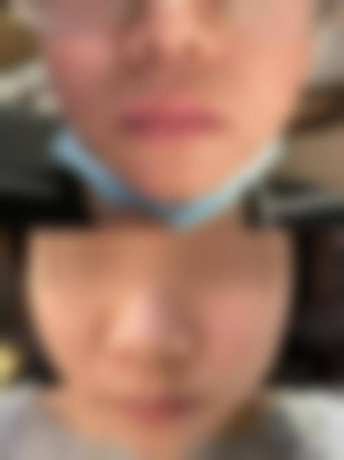 陇南天艺整形美容中 心擅长项目。