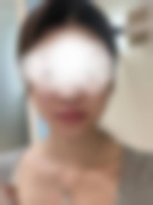 武警上海市总队医院整形科治疗反馈与口碑评价。