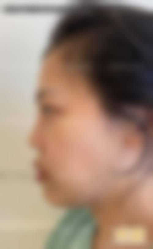 陇南天艺整形美容中 心医生团队经验稳定。