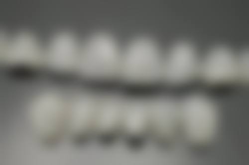 探秘德国泽康全瓷冠:美学与功能的和谐统一