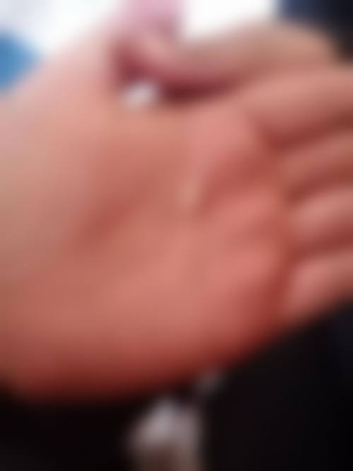 优惠活动详情：限时特别优惠，到院即享