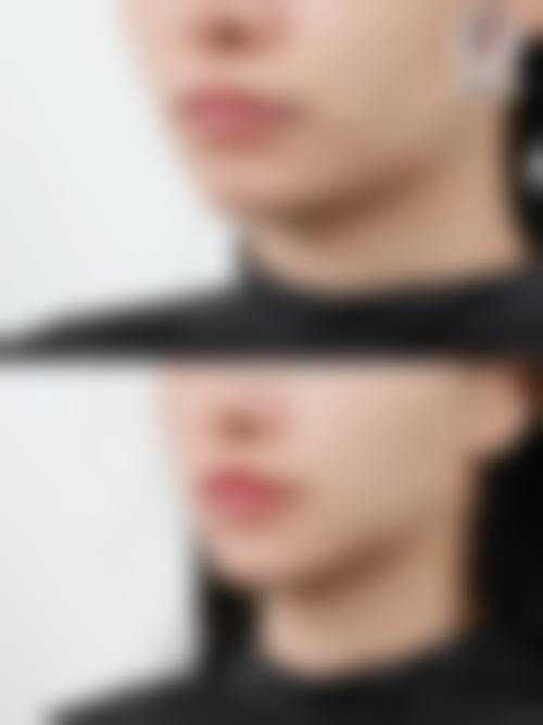成都高新大峰整形医院治疗反馈与口碑评价。