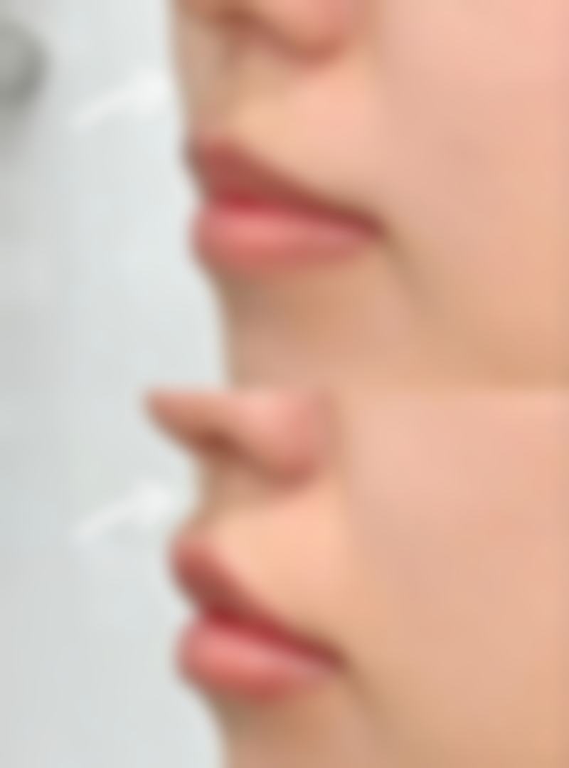骨折手指再造多久能好？医生详解：4个月恢复功能，康复训练是关键！