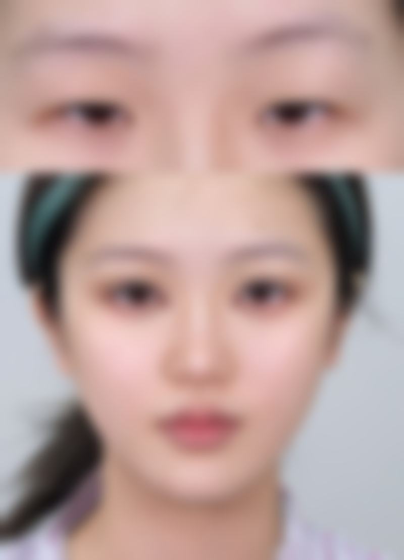 韓國伊美芝整形外科醫院價格表2026中韓報價 點樣預約更抵？隱藏優惠大公開
