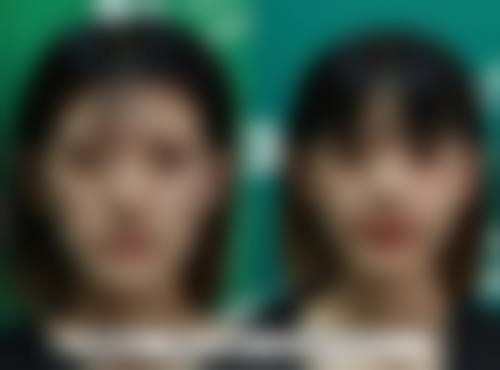 七、怎么判断自己是否适合生物补片手术
