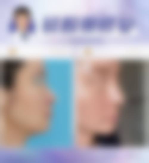 不错的技术保护